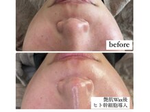 リノ(Lino)の雰囲気(産毛や角質を整え、くすみのない艶肌へ導く人気ケア)