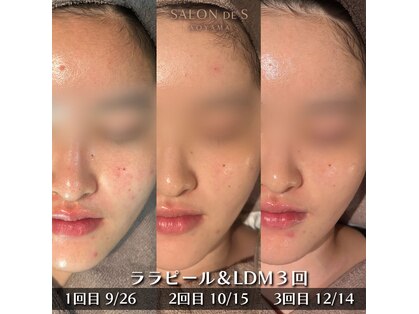 サロン ド エス アオヤマ(SALON DE S AOYAMA)の写真