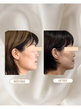 トロワ(TROIS)/ずっとお悩みだった赤ら顔も。