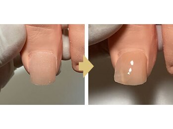 牛久巻き爪センター/7. 完了