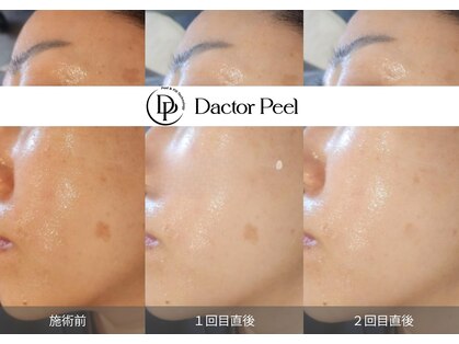 リュエル(RUELLE)の写真