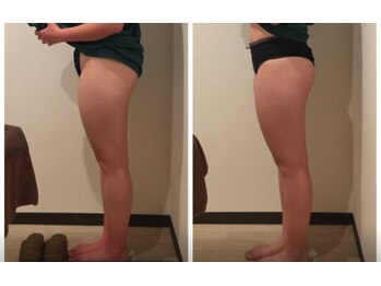 リズ(Liz)/光痩身美脚になりたい