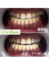 ルブラン 奈良店(Le Blanc)/コーヒーのステイン