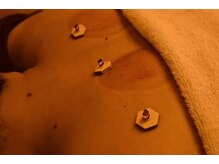 デルタエヌピー63+(δnp63+)/お客様施術例【小顔/薬院/福岡】