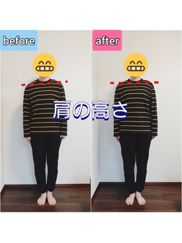 エンビジョン(ENVISION)/before→after