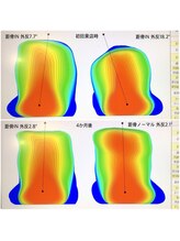 ビオプラス 広尾本店(bioplus)/施術例