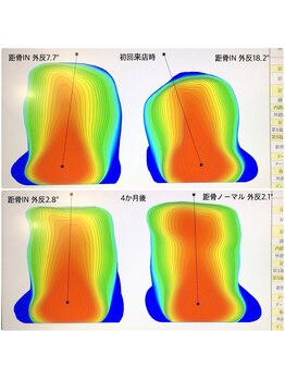 ビオプラス 広尾本店(bioplus)/施術例