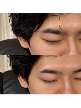 アルデオンワン セカンド(ARDEON.1 second)/【メンズ眉毛】Before/after