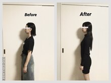 ショウフェイスデザイン(Sho Face Design)/《全身矯正》ビフォーアフター