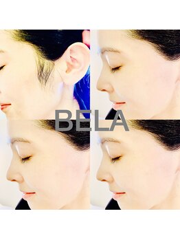 ベラ(BELA)/もみあげワッツクス