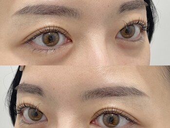 チャームアイ 札幌店(charm ai)の写真/≪当日予約歓迎♪西8丁目駅徒歩2分≫NEW OPEN札幌アイブロウ専門店『骨格＆パーツ診断』で拘り抜いた美眉技