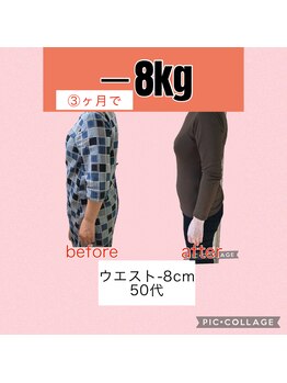 ヴェリテ(Verite)/before after