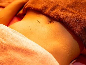 サロンラメール(Salon Lamer)の写真/【大宮駅の隣、日進駅から徒歩4分/温活×鍼灸】首肩こり腰痛/冷えむくみ/自律神経の乱れ原因を根本から改善