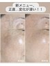 【大好評◎新メニュー】毛穴引き締め×プラズマ導入フェイシャル