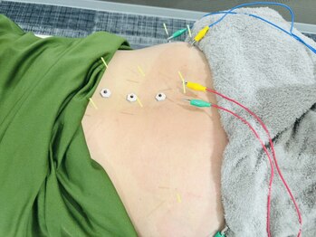 ザワ鍼灸接骨院(zawa鍼灸接骨院)/