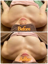 トータルボディセラピーハート(Heart)/【バストは必ず変わる】姿勢改善