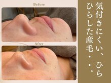 ベラノーブル(bella noble)/セルフでの処理は傷つきやすい。