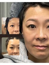 エントワ(ENTOWA)/眉毛は伸ばしていくもの