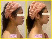 美肌痩身サロン ラエルヴェ(La Elever)/小顔リフトアップ大作戦！ 