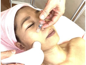 サロン ド フルール/真皮層まで栄養成分導入