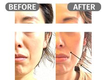 インフィニート 上野毛(infinito)/★BEFORE/AFTER★