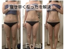 エクラ(Eclat)/痩せ辛いを解消！体脂肪削減