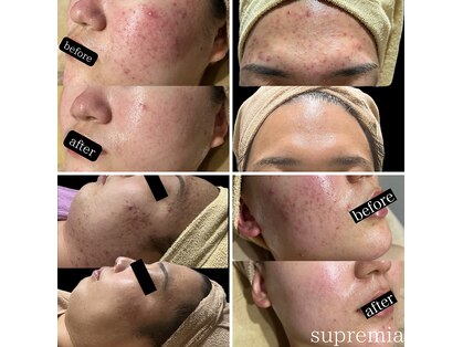 スプレミア(spuremia)の写真