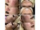 スプレミア(spuremia)の写真