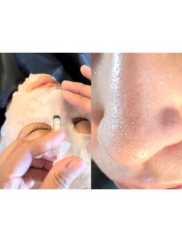 毛穴ケアをしたい