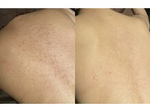 ジュエリーボディー(Jewelry body)/