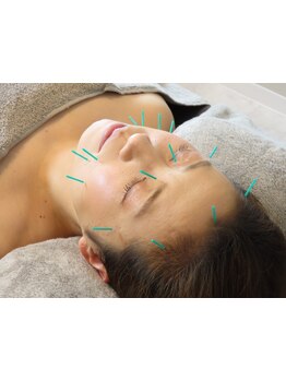 鍼灸施術を受けたい