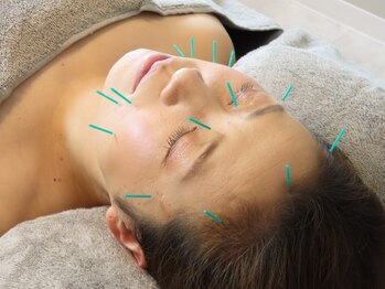 イリス 神田(iris)の写真/慢性疲労や不眠でお悩みの方にぴったり!東洋と西洋の技術を融合させた鍼灸技術で、心と体をリフレッシュ♪