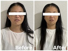 アンドブレインビューティー(and.Brain Beauty)/脳美容ドライヘッドスパ