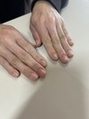 自爪風ネイル
