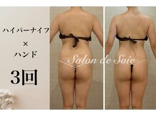 サロン ド ソワ(Salon de Soie)/ハイパーナイフ×ハンド3回