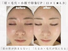 ビビット 久宝寺店(VIVIT)の雰囲気(【フェイシャル】八尾/JR久宝寺/毛穴/むくみたるみ小顔リンパ)