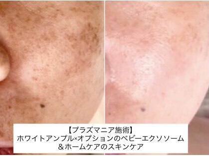 グラースア(grace a)の写真