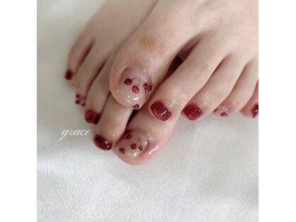 グレイス(grace)の写真