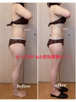 アンフィニ(infini)/短期集中コース5回目(2ヶ月)