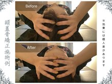 ボディ リセット アンド デザイン(Body Reset & Design)/【施術例】ビフォーアフター