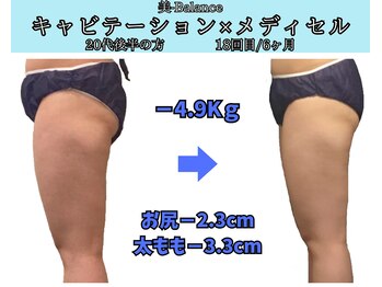 ビーバランス 本町店(美-Balance)/20代後半　メディセル＋キャビ