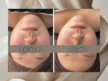 ゴールデンケア(goldencare)/【フェイスライン・顎】がお悩み