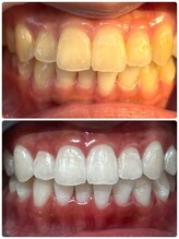 アンドホワイト 八日市店(&white)/メディカルホワイトニング