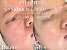 ルチーレ(Lucire)/クリスティーナ　1回目