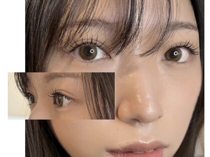 anneau 【アノー】の写真