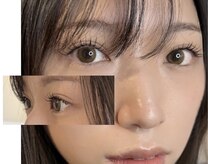 anneau 【アノー】