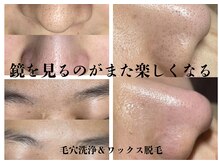 ビューティータワー(Beauty Tower)の雰囲気（毛穴洗浄、ワックス脱毛＆光脱毛でトリプルケアも◎）