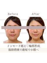 リスサロンドナース(LYS salon de Nurse)/【産後ママも◎】たるみシミケア