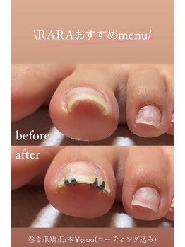 トータルビューティー ララ(Total Beauty RARA)/フットのトラブル解決！