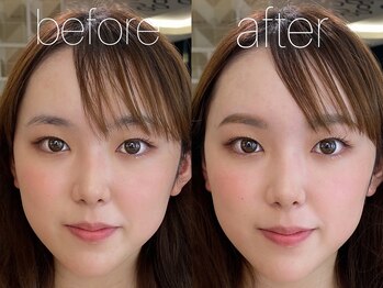 ビューティーガーデン イース/BEFORE→AFTER